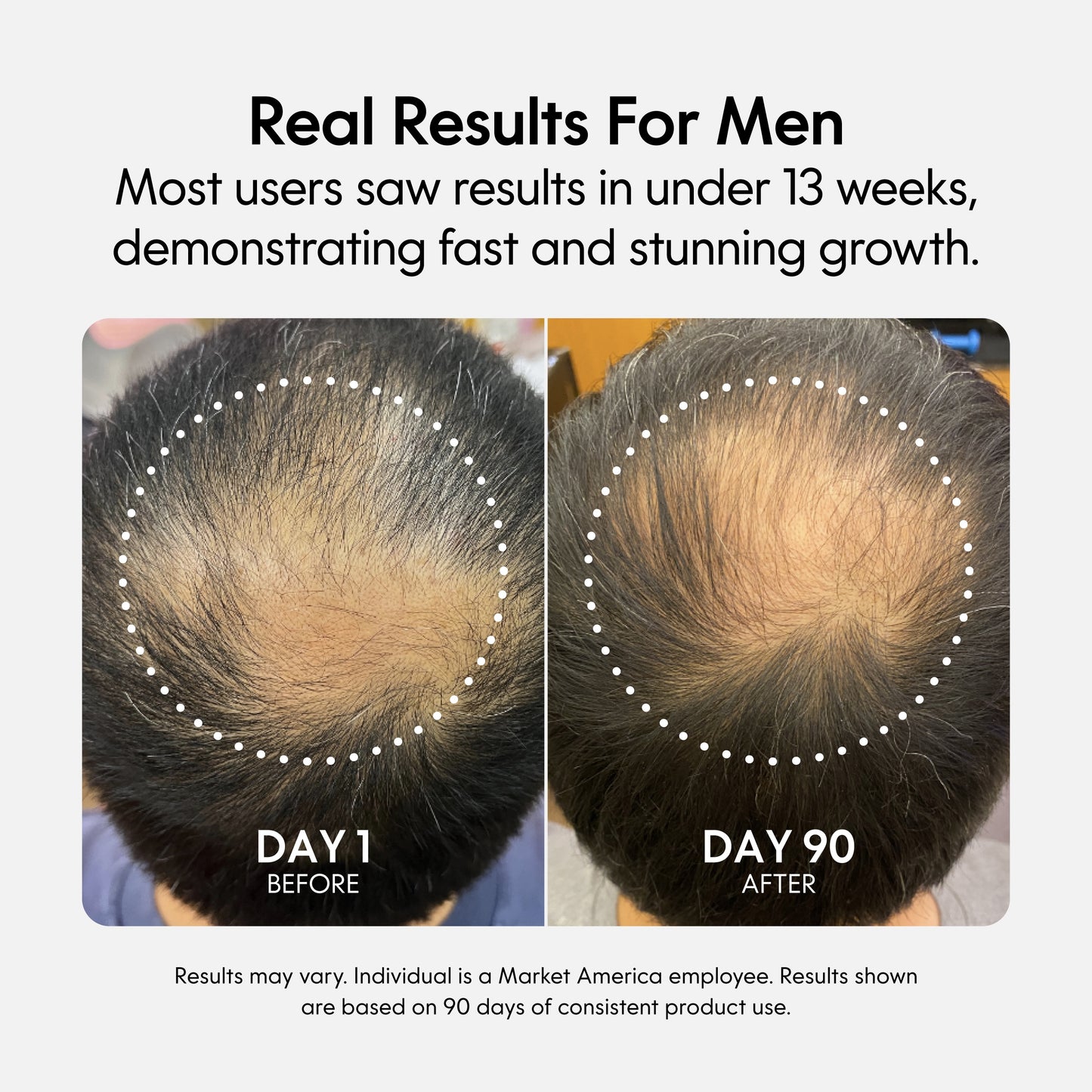 Fixx Hair Growth