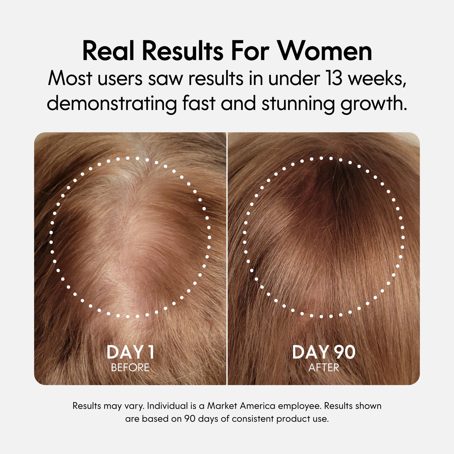 Fixx Hair Growth