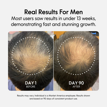 Fixx Hair Growth