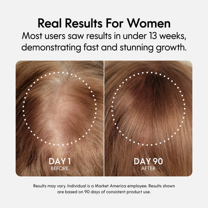 Fixx Hair Growth
