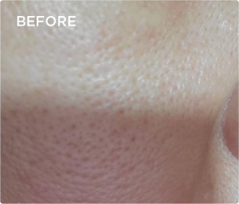 Lumière de Vie®菁妍露（保濕晶露）