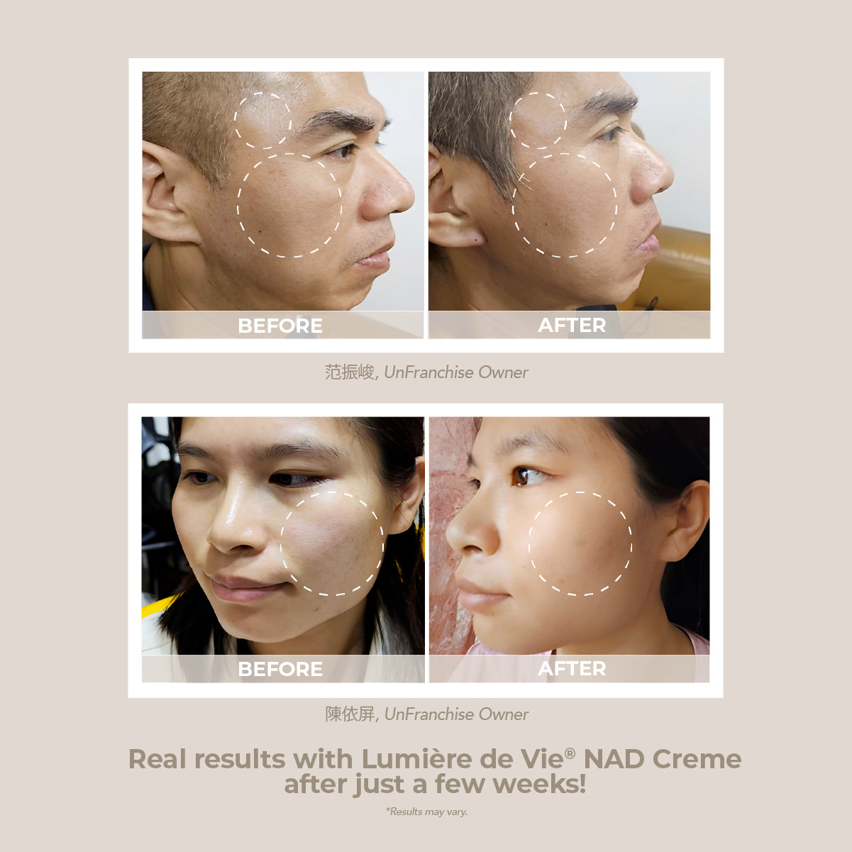 Lumière de Vie® NAD Crème